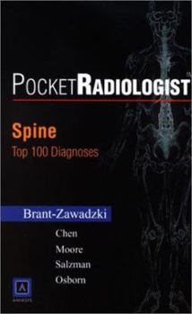 Paperback Pocketradiologist - Spine: Top 100 Diagnoses Book