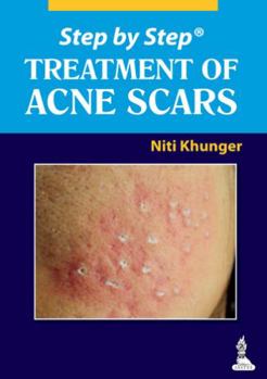 Paperback Step by Step: Treatment of Acne Scars Book