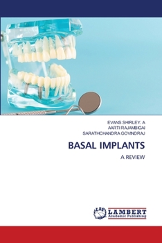 Paperback Basal Implants Book