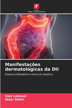 Manifestações dermatológicas da DII (Portuguese Edition)