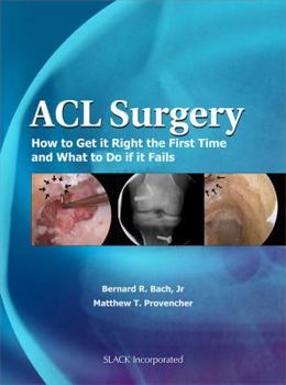 Hardcover ACL Surgery: How to Get It Right the First Time and What to Do If It Fails Book