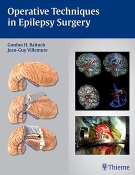 Hardcover Operative Techniques in Epilepsy Surgery Book