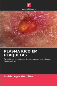 Paperback Plasma Rico Em Plaquetas [Portuguese] Book