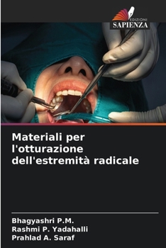Materiali per l'otturazione dell'estremità radicale (Italian Edition)