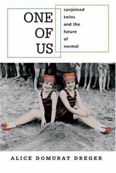 Hardcover One of Us: Conjoined Twins and the Future of Normal Book