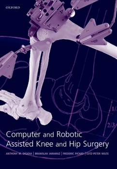 Hardcover Computer and Robotic Assisted Hip and Knee Surgery Book