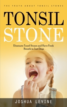 Paperback Tonsil Stones: The Truth about Tonsil Stones (Eliminate Tonsil Stones and Have Fresh Breath in Just Days!) Book
