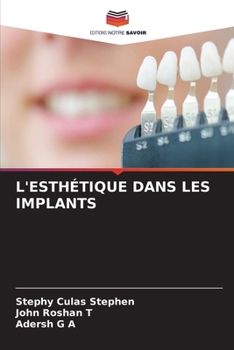 Paperback L'Esthétique Dans Les Implants [French] Book