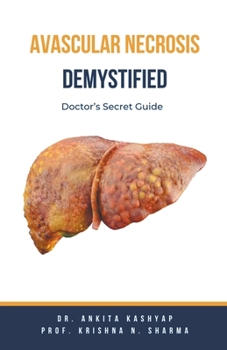 Paperback Avascular Necrosis Demystified: Doctor's Secret Guide Book