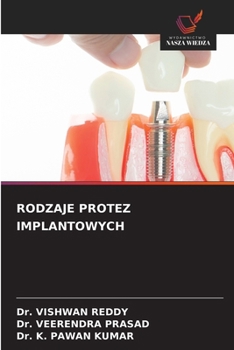 Rodzaje Protez Implantowych (Polish Edition)