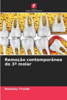 Paperback Remoção contemporânea do 3° molar [Portuguese] Book