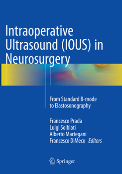 Paperback Intraoperative Ultrasound (Ious) in Neurosurgery: From Standard B-Mode to Elastosonography Book