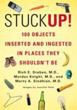 Paperback Stuck Up!: 100 Objects Inserted and Ingested in Places They Shouldn't Be Book