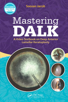 Paperback Mastering DALK: A Video Textbook on Deep Anterior Lamellar Keratoplasty Book