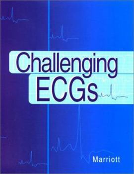 Paperback Challenging Ecgs Book