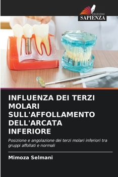 Paperback Influenza Dei Terzi Molari Sull'affollamento Dell'arcata Inferiore [Italian] Book
