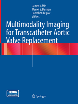 Paperback Multimodality Imaging for Transcatheter Aortic Valve Replacement Book