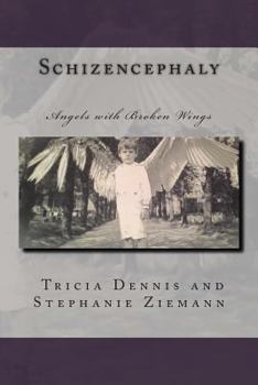 Paperback Schizencephaly Book