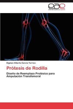 Paperback Protesis de Rodilla [Spanish] Book