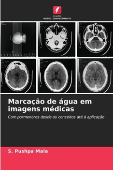 Paperback Marcação de água em imagens médicas [Portuguese] Book