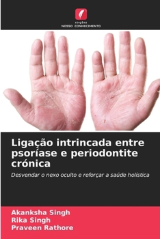 Paperback Ligação intrincada entre psoríase e periodontite crónica [Portuguese] Book