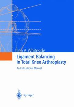Hardcover Ligament Balancing in Total Knee Arthroplasty: An Instructional Manual Book