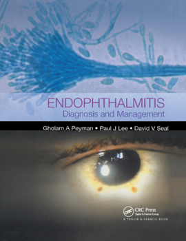Paperback Endophthalmitis: Diagnosis and Treatment Book