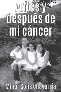 Paperback Antes y después de mi cáncer [Spanish] Book