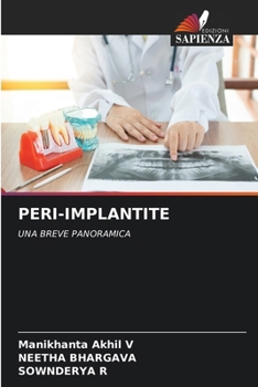 Paperback Peri-Implantite [Italian] Book