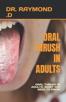 Paperback Oral Thrush in Adults: Oral Thrush in Adults: What You Need to Know Book