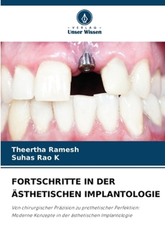 Fortschritte in Der Ästhetischen Implantologie (German Edition)
