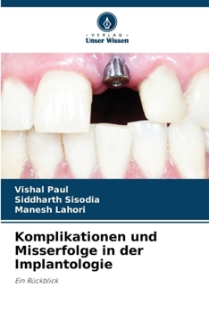 Paperback Komplikationen und Misserfolge in der Implantologie [German] Book