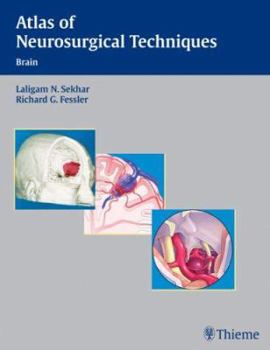 Hardcover Atlas of Neurosurgical Techniques: Brain Book