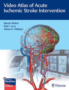 Hardcover Video Atlas of Acute Ischemic Stroke Intervention Book