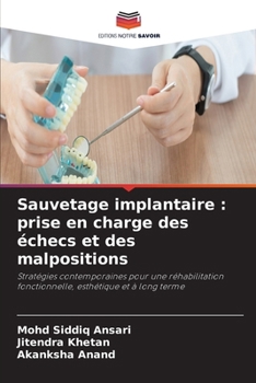 Paperback Sauvetage implantaire: prise en charge des échecs et des malpositions [French] Book