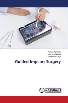 Guided Implant Surgery