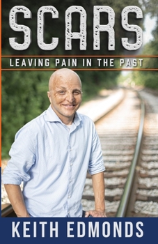 Paperback Scars Leaving Pain in the Past Book