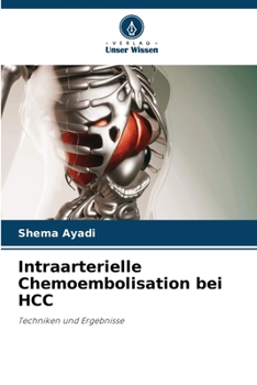 Paperback Intraarterielle Chemoembolisation bei HCC [German] Book