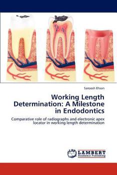 Paperback Working Length Determination: A Milestone in Endodontics Book