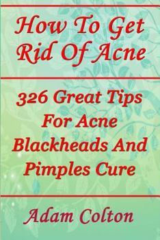 Paperback How To Get Rid Of Acne: 326 Great Tips For Acne Blackheads And Pimples Cure Book