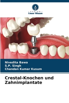 Paperback Crestal-Knochen und Zahnimplantate [German] Book