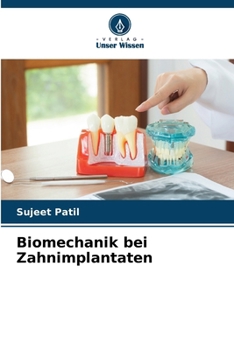 Biomechanik bei Zahnimplantaten