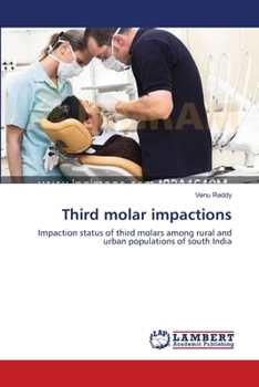 Paperback Third molar impactions Book