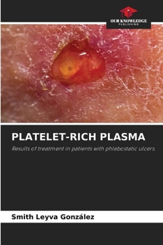 Paperback Platelet-Rich Plasma Book