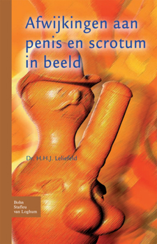 Paperback Afwijkingen Aan Penis En Scrotum in Beeld [Dutch] Book