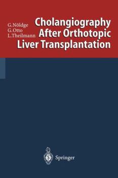 Paperback Cholangiography After Orthotopic Liver Transplantation Book