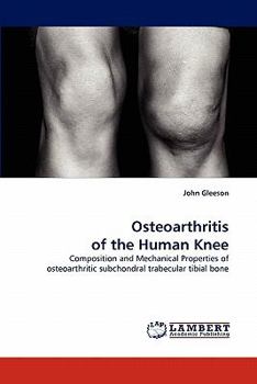 Paperback Osteoarthritis of the Human Knee Book