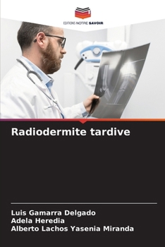 Paperback Radiodermite tardive [French] Book