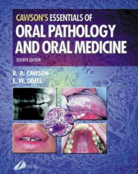 Paperback Cawson's Essentials of Oral Pathology and Oral Medicine Book