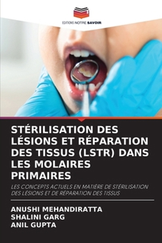 Paperback Stérilisation Des Lésions Et Réparation Des Tissus (Lstr) Dans Les Molaires Primaires [French] Book